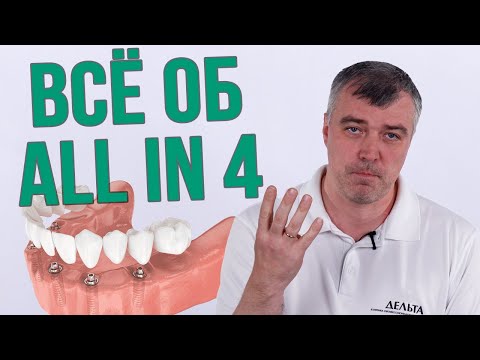 Вся правда об имплантации All on 4 все на четырех (Школа здоровых зубов) #шзз