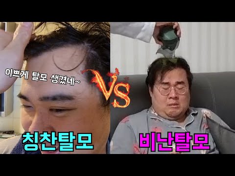 같이 사는형 머리로 칭찬탈모vs비난탈모 실험해보기ㅋㅋㅋ