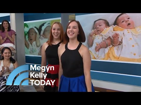 Conjoined Twin Sisters Tell Their Story: ‘Being By Her … It’s So Calming' | Megyn Kelly TODAY