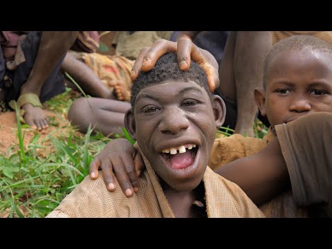 They Call Me Monkey Now I Bought a Brand New House For My Mom : EXTRAORDINARY STORY