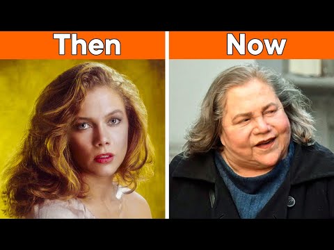5 Shocking Stars’ Plastic Surgery Transformations! | Then and Now 2025