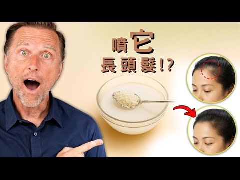 噴一噴，助長頭髮? 重建頭髮菌群的14天自然療法,柏格醫生 Dr Berg