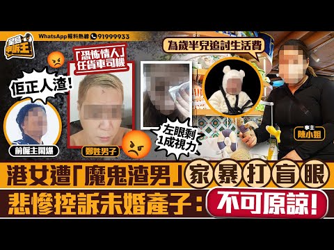 港女遭「魔鬼渣男」家暴打盲眼 悲慘控訴未婚產子：他不可原諒｜星島申訴王｜港女｜渣男｜控訴｜星島頭條