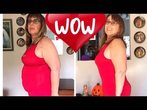 1328. ИСТОРИЯ АБДОМИНОПЛАСТИКИ !!! МОЙ ЖИВОТ ДО И ПОСЛЕ !!