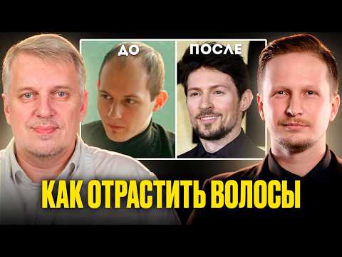 Male pattern baldness | How to stop hair loss? Trichologist Nikolay Goncharenko WORKING COUNCILS