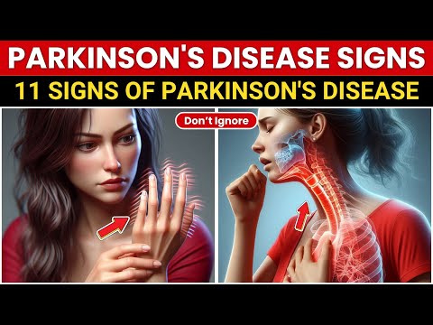 11 Warning Signs of Parkinson's Most People Ignore Until It's Too Late