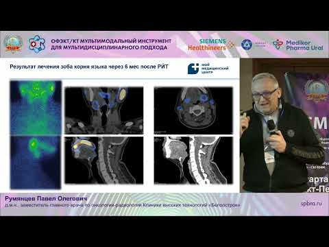 ОФЭКТ Ядерная Медицина в клинических рекомендациях: Эндокринология