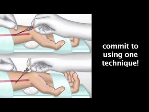 Arterial Line Placement by J. DiNardo | OPENPediatrics