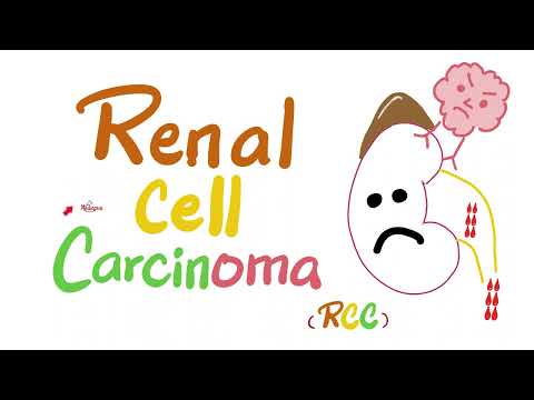 Renal Cell Carcinoma (RCC) - Kidney Tumors - Neoplasms - Renal Pathology - Nephrology