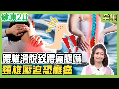 五月天石頭曾受脊椎滑脫苦！「這動作」害腰椎滑脫致腰痛腿麻！頸椎壓迫恐癱瘓錯位逾5成要手術！骨質疏鬆致腰椎骨折！健康2.0 20250503【完整版】#鄭凱云 #花世源 #羅佳琳 #胡逸惟 #小CALL