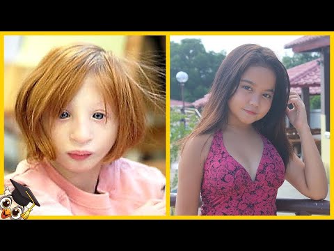 20 Children Who Are Only Born Once in a Thousand Years