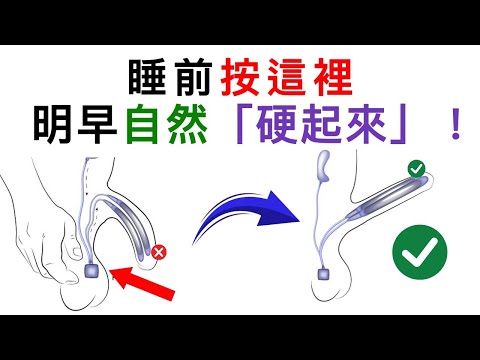 王凯辉醫師：睡前按這裡，讓你早晨自然硬起來！（男人過50必看）