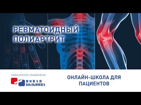 Ревматоидный полиартрит