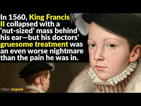 The Most Disgusting Death In French Royal History