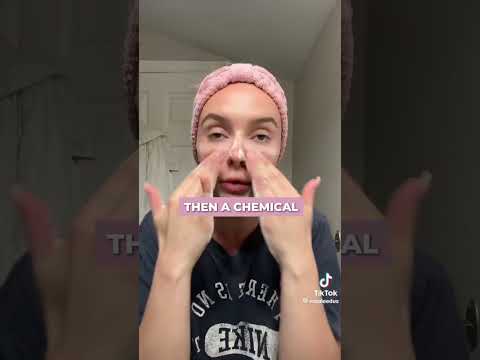 Bumpy chin and forehead hack