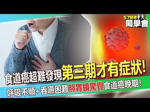 食道癌超難發現「第三期才出現症狀」？ 40歲男呼吸不順+吞嚥困難「照胃鏡才驚覺」食道癌晚期！【 @57healthy  】#鄭丞傑 醫師