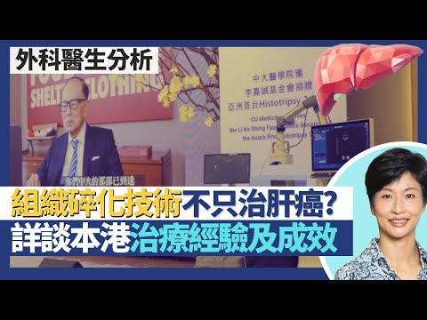 肝癌無創組織碎化治療｜李嘉誠基金會Histotripsy贈港成亞洲先驅 詳談香港治療經驗及成效！組織碎化技術不只可治肝癌？組織碎化治療VS其他肝癌治療！｜王建芳醫生 外科醫生竺兆豪醫生｜人類健康研究所
