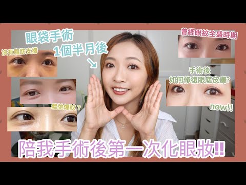 ♥ BYEBYE眼袋#3 ♥ 終於手術後第一次化眼妝👀 公開個月半後素眼狀態💁🏽‍♀️眼袋手術後會爆眼紋？我是如何修復眼底皮膚？ || Dottie Hidee ||(合作)