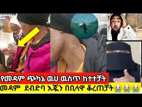 የመዳም ጭካኔ ልትገላትነዉእጇን በቢላዋ ቆረጠቻት ዉሀ ዉስጥ ከተተቻት አረቦች ከፍተዋል