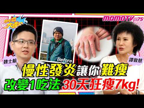慢性發炎 讓你難瘦 改變1吃法30天狂瘦7kg! ft. 魏士航 醫師 譚敦慈【 小宇宙大爆發 】
