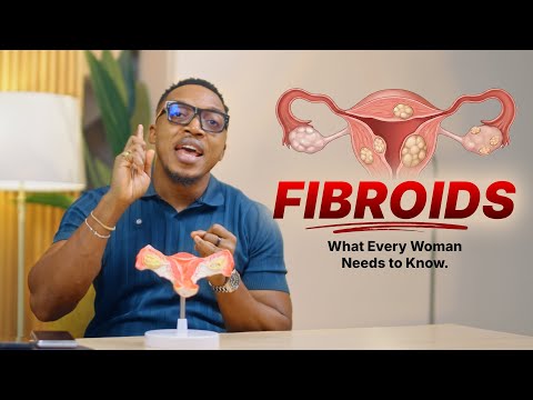 This is what causes fibroids! 