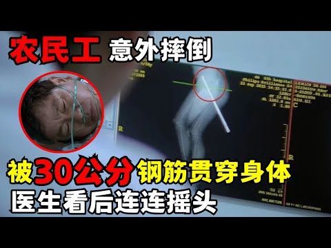 农民工意外摔倒被钢筋贯穿身体, 30公分钢筋从大腿刺进腹部, 医生看后连连摇头｜走进急诊