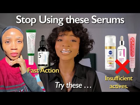 How to Fade Dark spots & Hyperpigmentation Quickly | Use these brightening Serums Instead.