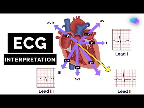 How to Read an ECG | ECG Interpretation | EKG | OSCE Guide | UKMLA | CPSA | PLAB 2