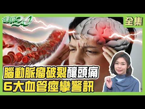 女歌手異常打鼾猝逝！腦動脈瘤破裂釀頭痛，6大血管痙攣警訊！頸動脈增厚血管老10歲！健康2.0 【完整版】#鄭凱云 #丁賢偉 #鄔定宇 #吳宏乾 #陳麗華 #雷議宗