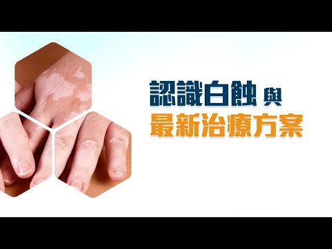 認識白蝕與最新治療方案