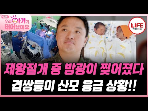 [#우리아기가태어났어요] 1/100,000 확률인 겹쌍둥이! 아이만 건강하길 기도했는데 산모에게 문제가?! (TV CHOSUN 250620 방송)