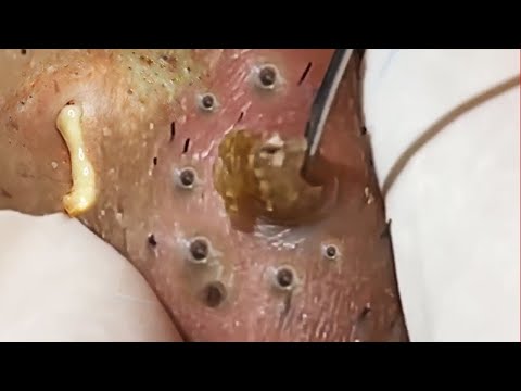 𝑨𝒄𝒉𝒊𝒆𝒗𝒆 𝑰𝒏𝒏𝒆𝒓 𝑷𝒆𝒂𝒄𝒆 𝑾𝒊𝒕𝒉 𝑻𝒉𝒆𝒔𝒆 𝑭𝒂𝒄𝒊𝒂𝒍 𝑪𝒍𝒆𝒂𝒏𝒔𝒊𝒏𝒈 #900865