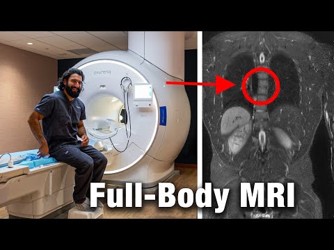 I Did a $2,500 Prenuvo MRI Scan. My Surprising Results