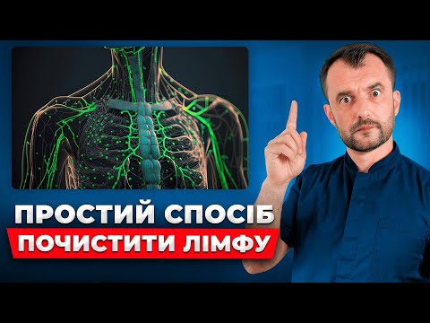 Як правильно і швидко ПОЧИСТИТИ ЛІМФУ БЕЗ ЛІКАРІВ! Як позбутися набряків