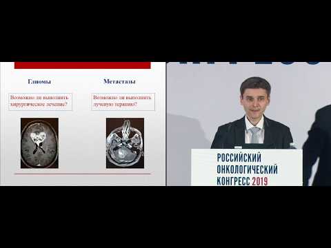 Можно ли избежать ЛТ при глиомах и метастазах в головном мозге?