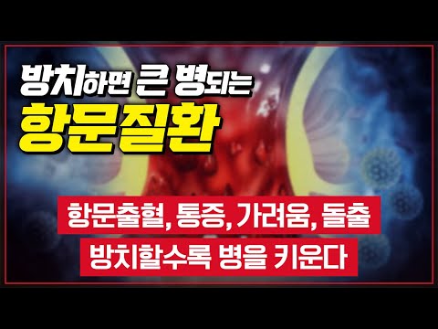 통증, 가려움, 출혈, 돌출.. 삶의 질을 떨어트리는 '항문질환' 증상이 의심된다면 반드시 병원을 찾아야 합니다 [ TV닥터인사이드 ] 20170601