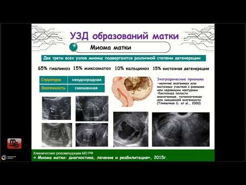 Вебинар "Ультразвуковая диагностика в гинекологии в соответствии с клиническими рекомендациями"