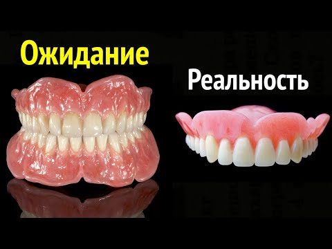 ПРИМЕРКА - этап, где ВСЁ решается!) ............ #съёмныепротезы #протезированиезубов #стоматология