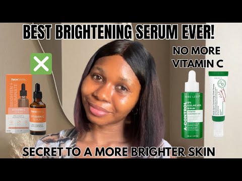 Best Brightening Face Serums You NEED Now! | Dark Spots, Hyperpigmentation & Uneven Skin Tone