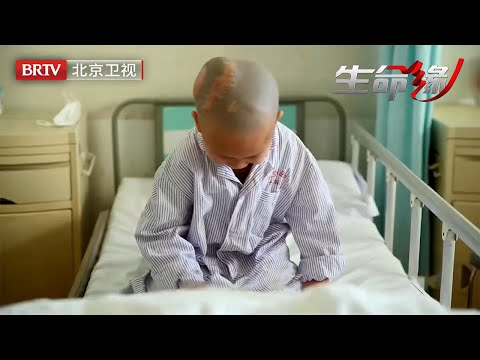5岁男童头部畸形，竟天生没有头骨，像软壳鸡蛋般脆弱，在场医生护士手都在发抖【生命缘第12季】