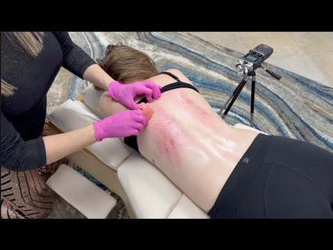 Pulling GUNK & Toxins from the Spine + Working on kyphosis