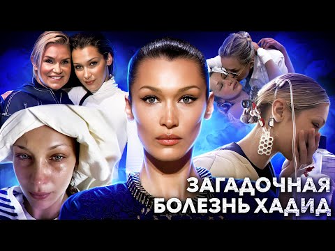 ТАЙНА БЕЛЛЫ ХАДИД: так ли реальна болезнь Лайма семейства Хадид? поклонники бьют тревогу...