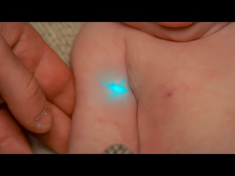 Poor Baby Is Born With a Mysterious Mark That Could Make Him King