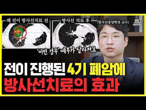 항암만으론 부족합니다…치료통증 줄이고 생존 늘리는 4기 폐암을 바꾼 ‘단 한 가지 치료’
