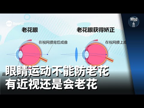 狮城有约 | 眼睛运动不能防老花 有近视还是会老花