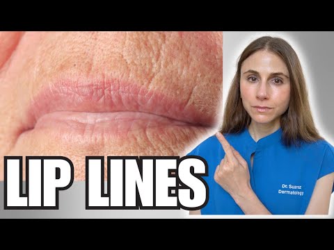 How to Get Rid of Smoker’s Lines | Dermatologist Explains Causes & Treatments