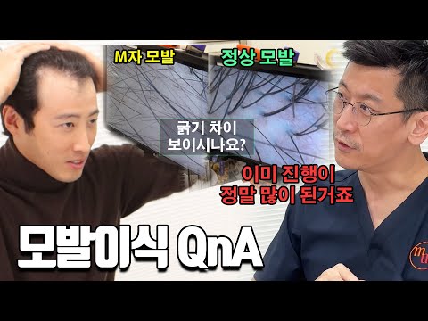 모발이식에 대해 모든 것을 묻고 왔습니다. 여러분은 늦지말고 결정 빨리하세요...