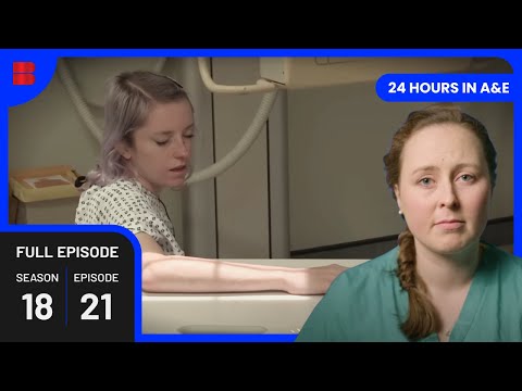 Acrobat’s Career at Risk After Terrifying Fall | 24 Hours In A&E