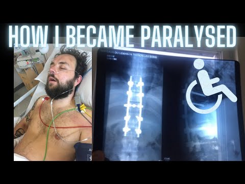 How I Became Paralyzed - My Story