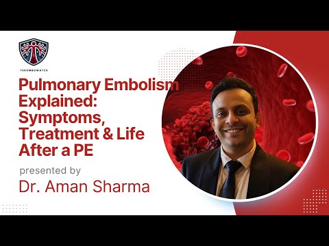 Pulmonary Embolism Explained  Symptoms, Treatment & Life After a PE | Dr  Aman Sharma